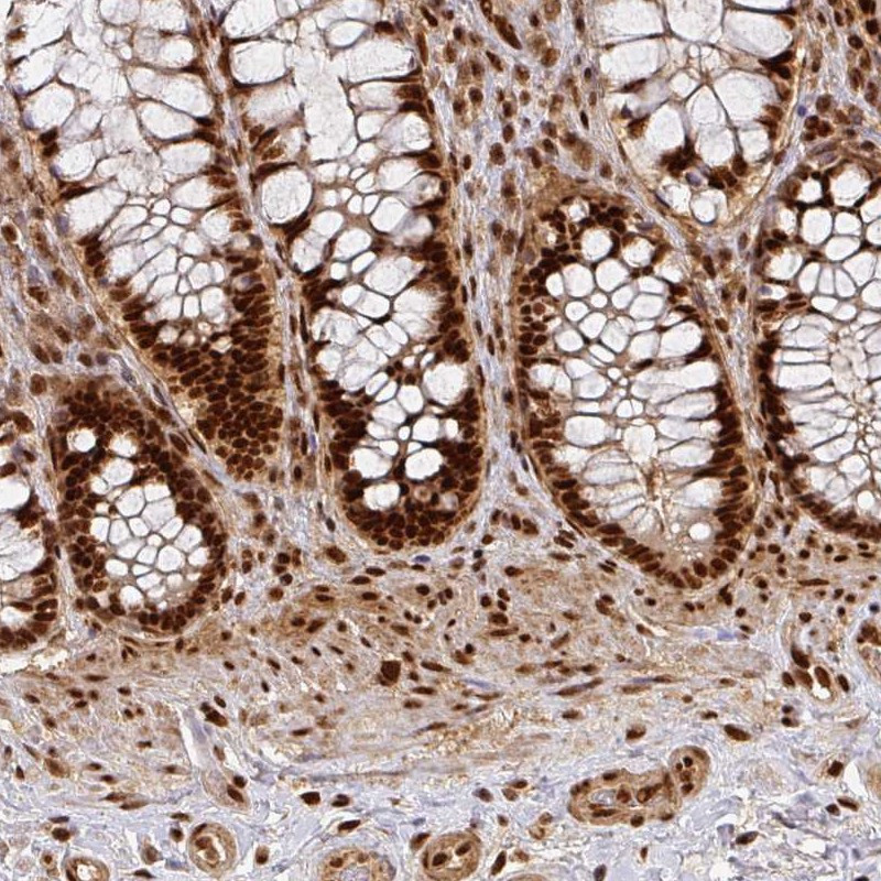 Immunohistochemical staining of human rectum shows strong nuclear positivity in glandular cells.