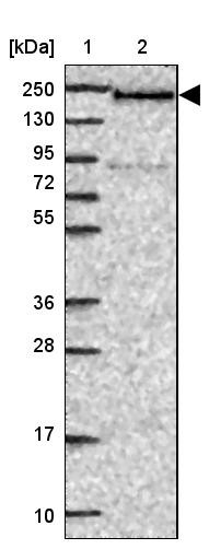 Lane 1: Marker [kDa] 250, 130, 95, 72, 55, 36, 28, 17, 10<br/>Lane 2: Human cell line RT-4