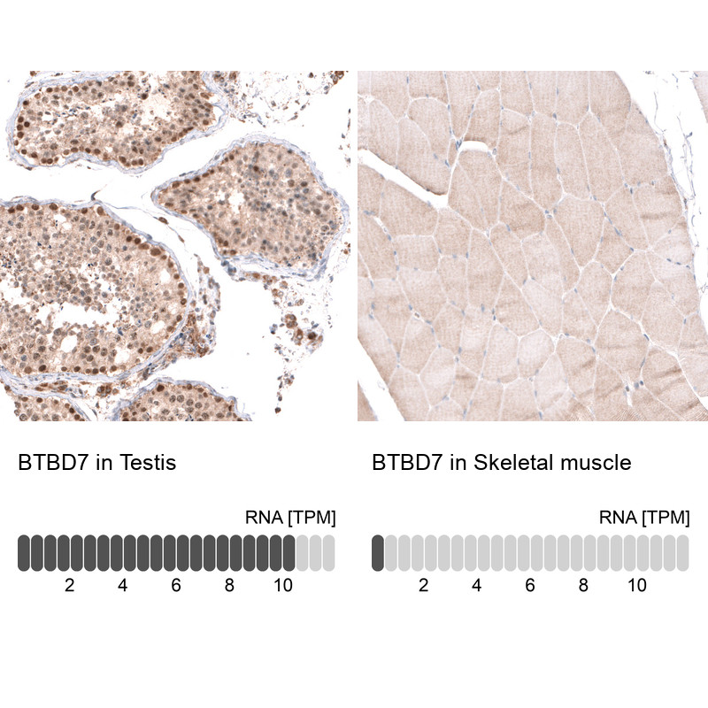 Immunohistochemistry analysis in human testis and skeletal muscle tissues using HPA049926 antibody. Corresponding BTBD7 RNA-seq data are presented for the same tissues.