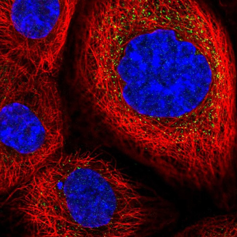 Immunofluorescent staining of human cell line A-431 shows localization to vesicles.