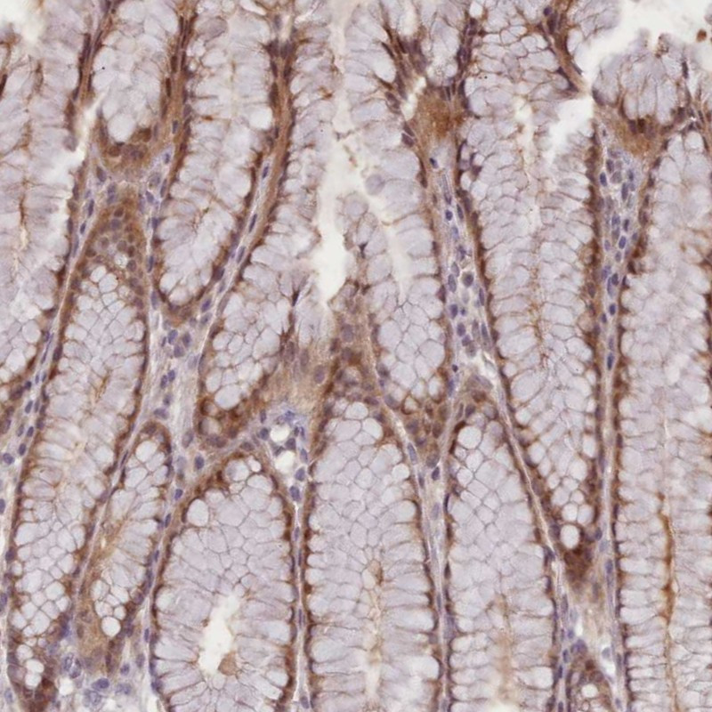 Immunohistochemical staining of human stomach, upper shows moderate cytoplasmic and nuclear positivity in glandular cells.