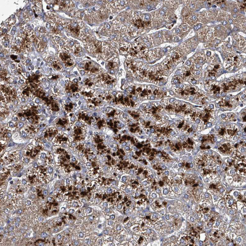 Immunohistochemical staining of human liver shows strong cytoplasmic granular positivity in hepatocytes.