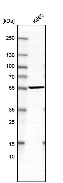 Lane 1: Marker [kDa] 250, 130, 95, 72, 55, 36, 28, 17, 10<br/>Lane 2: Human cell line RT-4