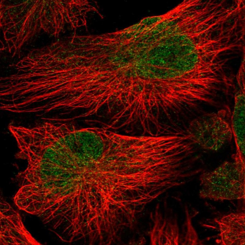 Immunofluorescent staining of human cell line U-251 MG shows localization to nucleoplasm.