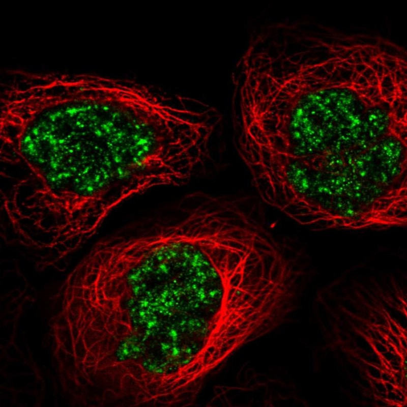 Immunofluorescent staining of human cell line A-431 shows localization to nuclear speckles.