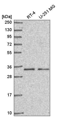 Western blot analysis in human cell line RT-4 and human cell line U-251 MG.