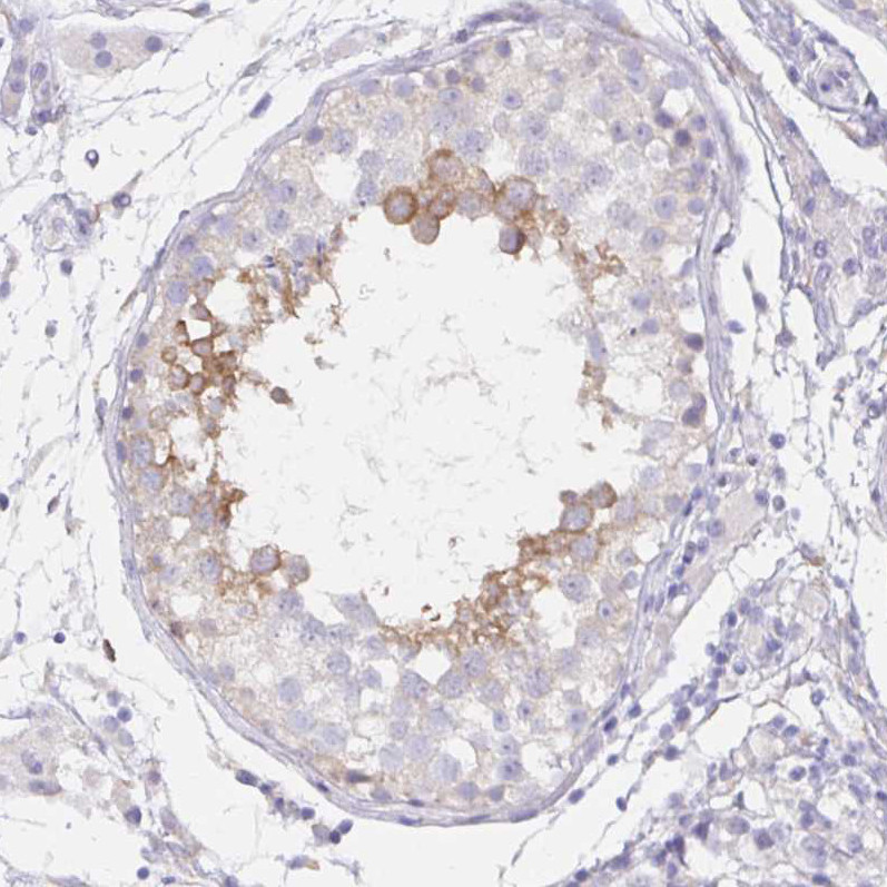 Immunohistochemical staining of human testis shows moderate  membranous and cytoplasmic positivity in cells in seminiferous ducts.