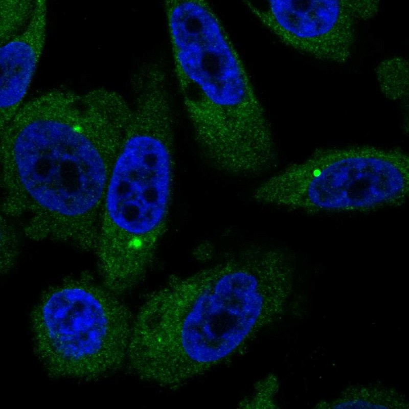 Immunofluorescent staining of human cell line PC-3 shows localization to cytosol.