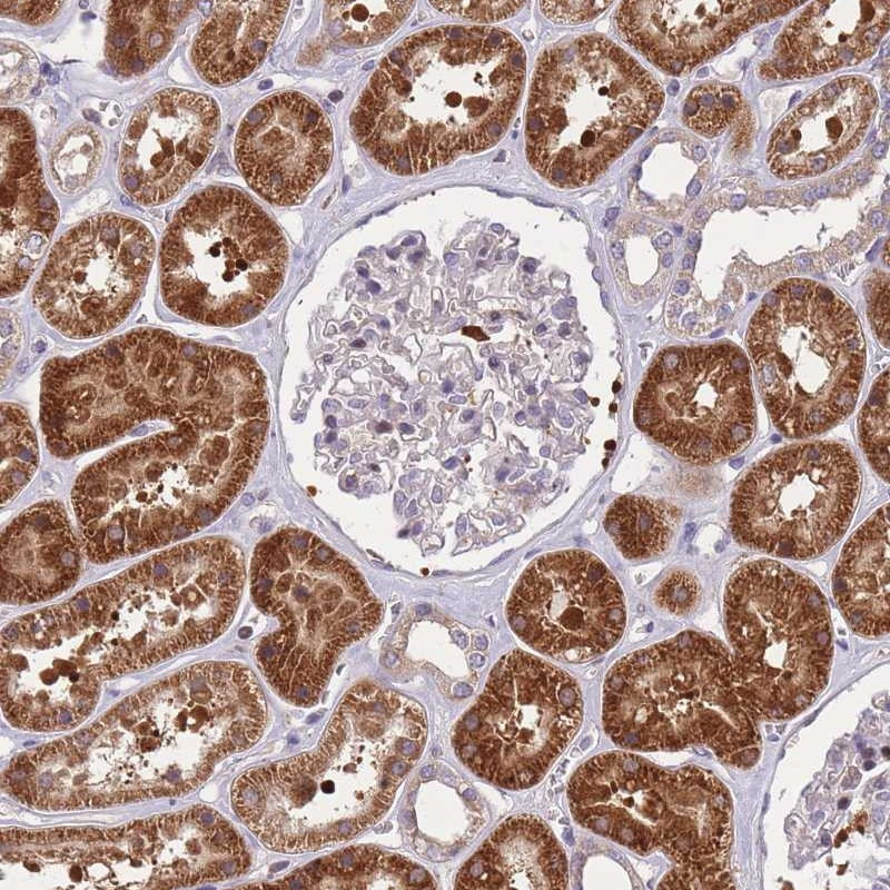 Immunohistochemical staining of human kidney shows strong cytoplasmic positivity in cells in tubules.