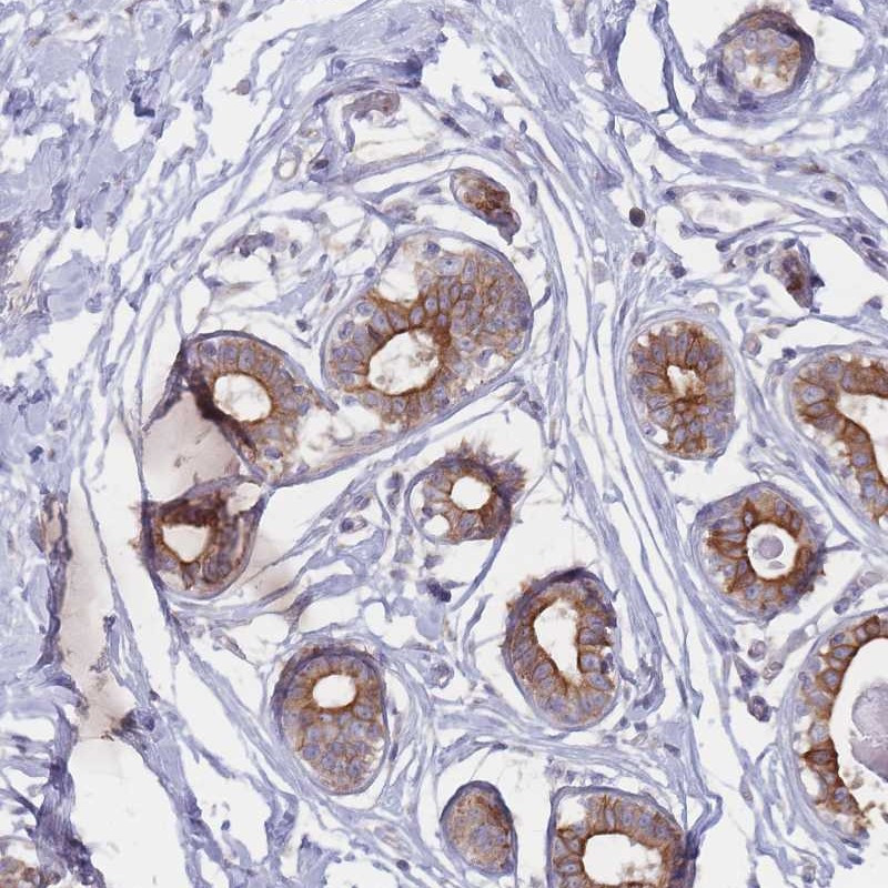 Immunohistochemical staining of human breast shows strong membranous positivity in glandular cells.