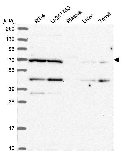 Western blot analysis in human cell line RT-4, human cell line U-251 MG, human plasma, human liver tissue and human tonsil tissue.