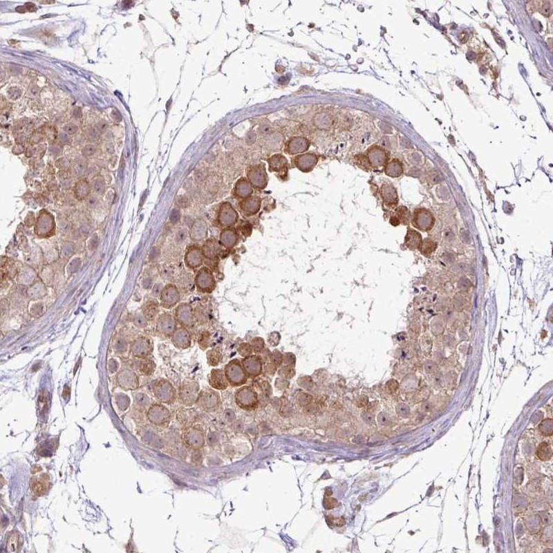 Immunohistochemical staining of human testis shows strong cytoplasmic positivity in cells of seminiferus ducts.