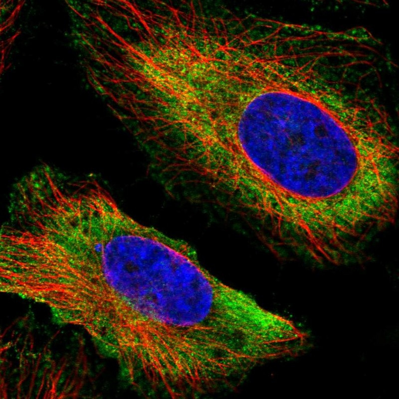 Immunofluorescent staining of human cell line HeLa shows localization to plasma membrane & cytosol.