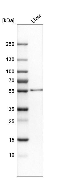 Western blot analysis in human liver tissue.
