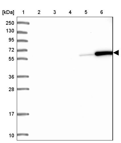 Lane 1: Marker [kDa] 250, 130, 95, 72, 55, 36, 28, 17, 10<br/>Lane 2: Human cell line RT-4<br/>Lane 3: Human cell line U-251MG sp<br/>Lane 4: Human plasma (IgG/HSA depleted)<br/>Lane 5: Human liver tissue<br/>Lane 6: Human tonsil tissue