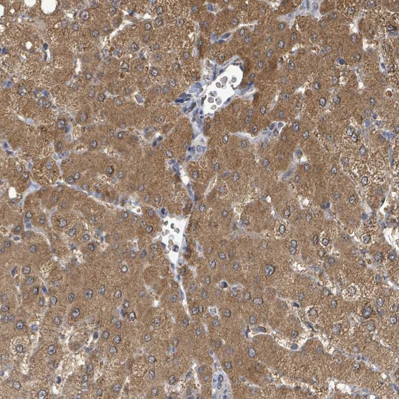 Immunohistochemical staining of human liver shows moderate cytoplasmic positivity in hepatocytes.