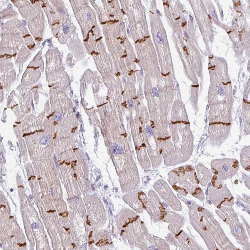 Immunohistochemical staining of human heart muscle shows strong positivity in intercalated discs.