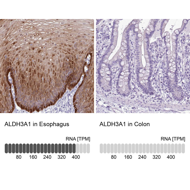 Immunohistochemistry analysis in human esophagus and colon tissues using Anti-ALDH3A1 antibody. Corresponding ALDH3A1 RNA-seq data are presented for the same tissues.