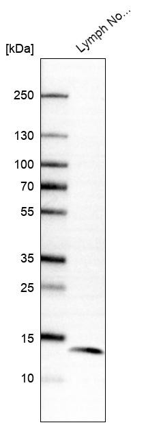 Western blot analysis in human lymph node tissue.