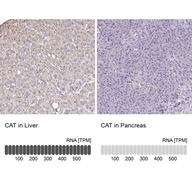 Immunohistochemistry analysis in human liver and pancreas tissues using Anti-CAT antibody. Corresponding CAT RNA-seq data are presented for the same tissues.