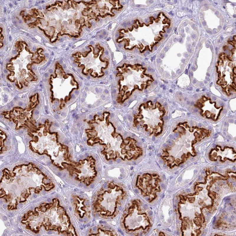 Immunohistochemical staining of human kidney shows strong membranous positivity in tubular cells.