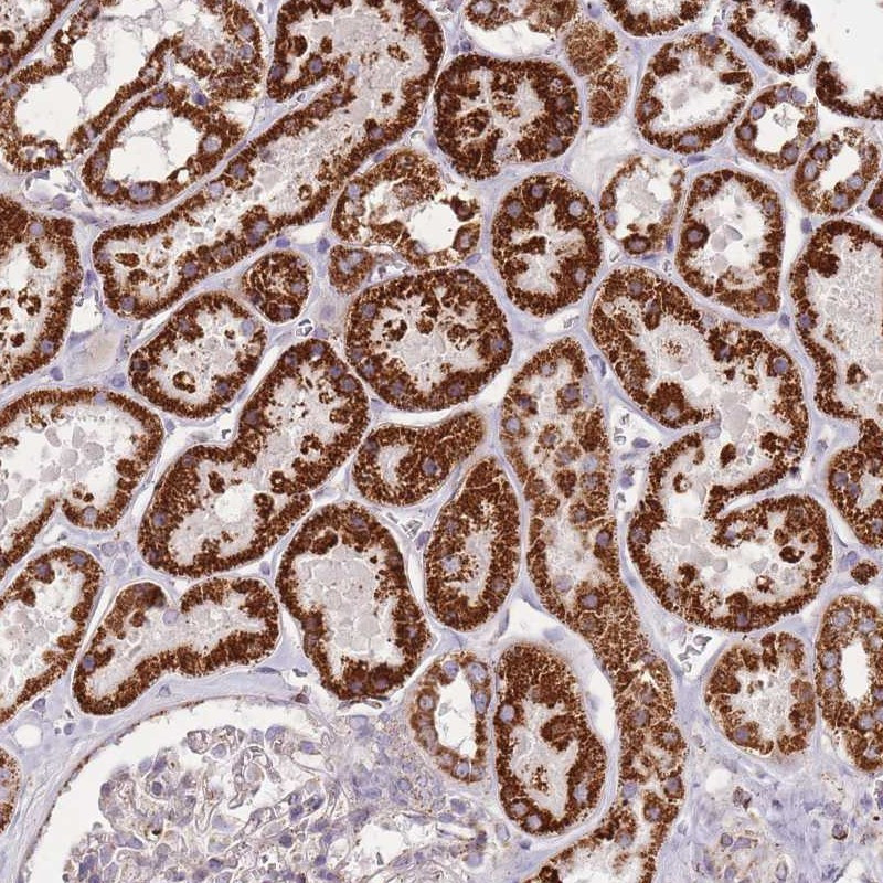 Immunohistochemical staining of human kidney shows strong cytoplasmic positivity in cells in tubules.