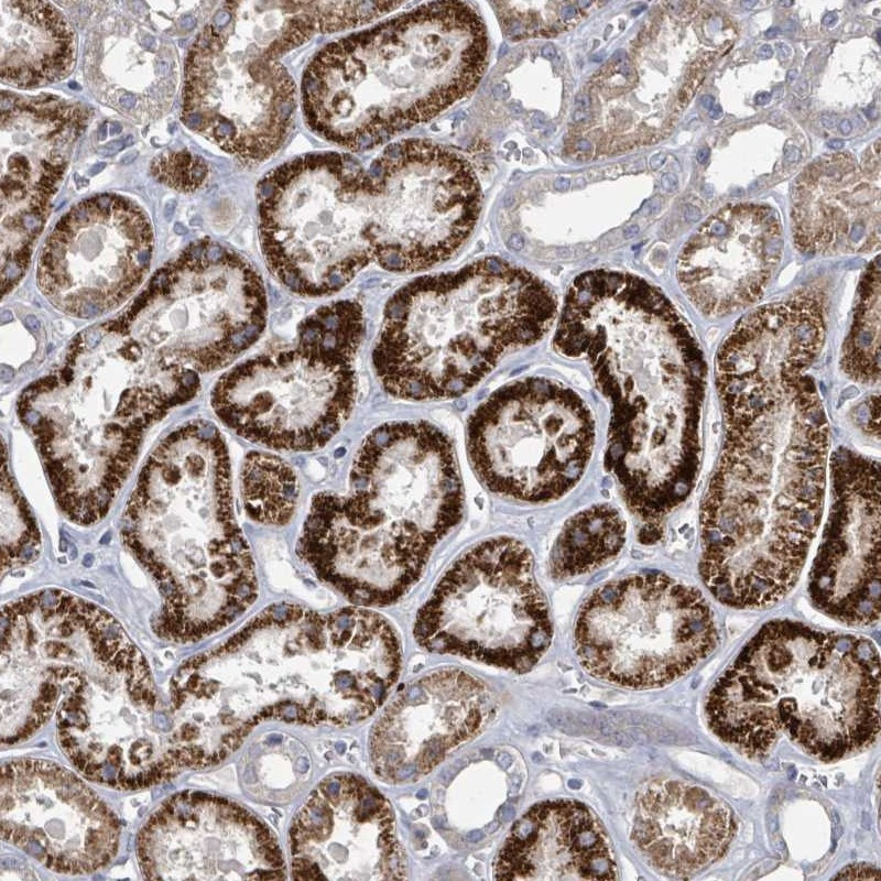 Immunohistochemical staining of human kidney shows strong cytoplasmic positivity in tubular cells.