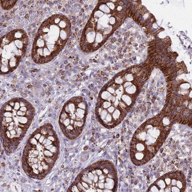 Immunohistochemical staining of human rectum shows strong cytoplasmic positivity in glandular cells.