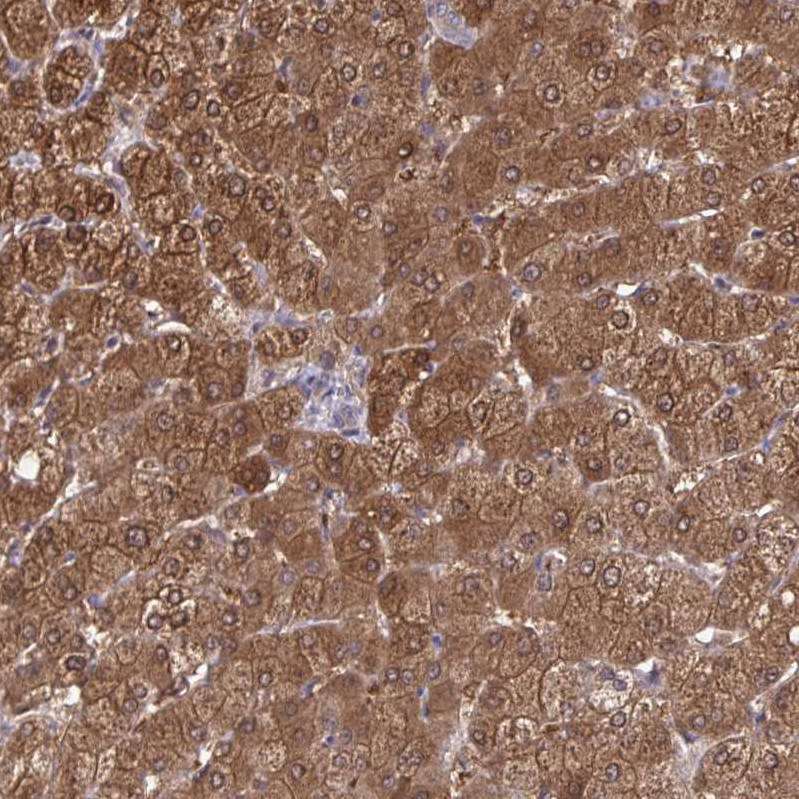 Immunohistochemical staining of human prostate shows strong cytoplasmic positivity in glandular cells.