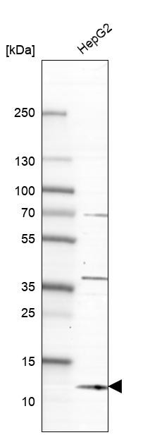 Lane 1: Marker [kDa] 250, 130, 95, 72, 55, 36, 28, 17, 10<br/>Lane 2: Human cell line RT-4<br/>Lane 3: Human cell line U-251 MG<br/>Lane 4: Human plasma<br/>Lane 5: Human Liver tissue