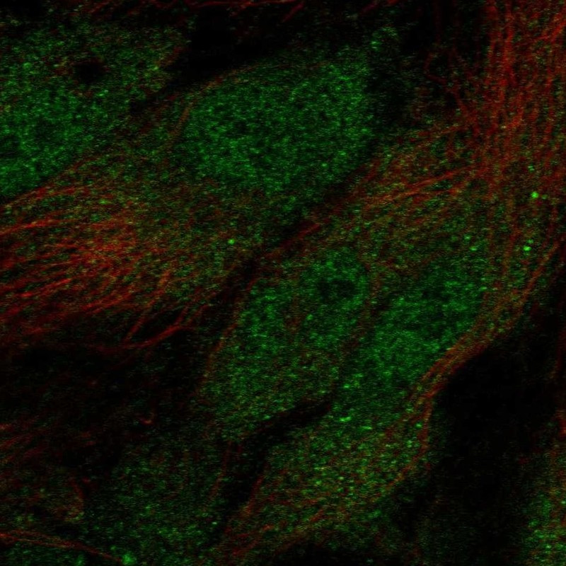 Immunofluorescent staining of human cell line HUVEC TERT2 shows localization to nucleoplasm, cytosol & cytoplasmic bodies.
