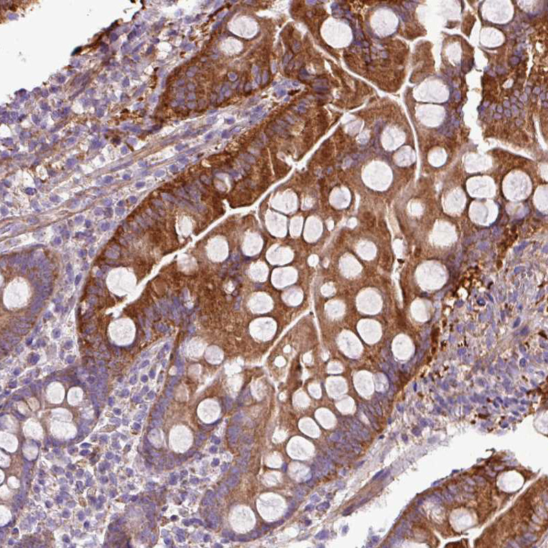 Immunohistochemical staining of human Small intestine shows moderate membranous positivity in glandular cells.