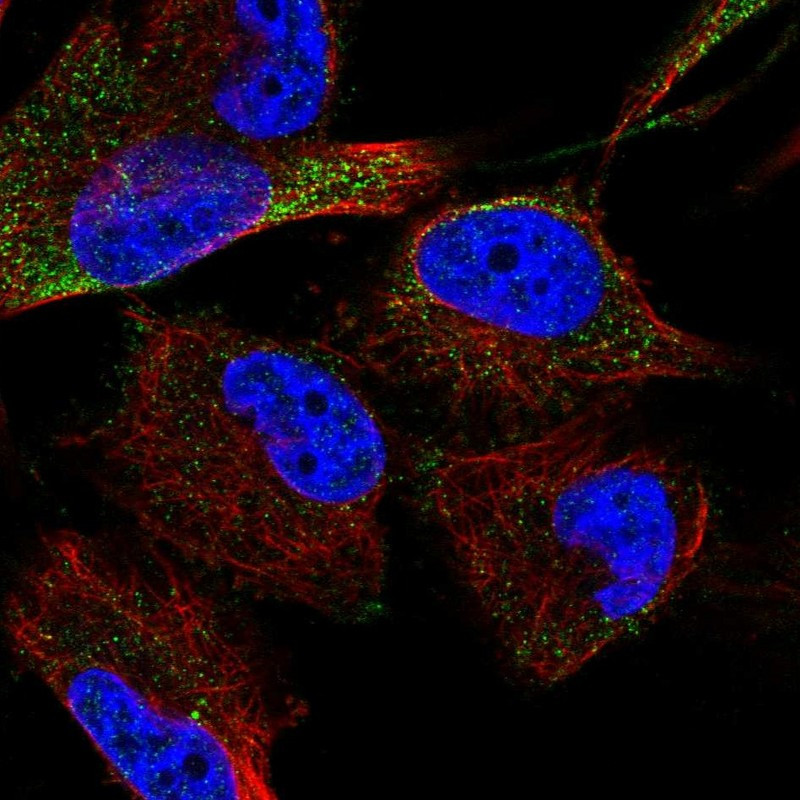 Immunofluorescent staining of human cell line U-251 MG shows localization to cytosol.