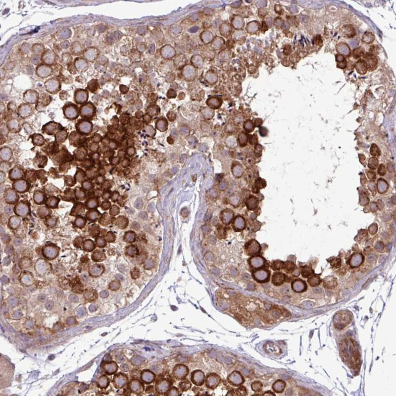 Immunohistochemical staining of human testis shows strong cytoplasmic positivity in cells in seminiferous ducts.