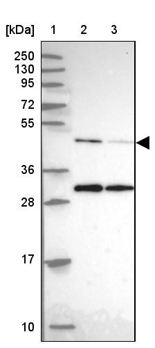 Lane 1: Marker [kDa] 250, 130, 95, 72, 55, 36, 28, 17, 10<br/>Lane 2: Human cell line RT-4<br/>Lane 3: Human cell line U-251MG sp