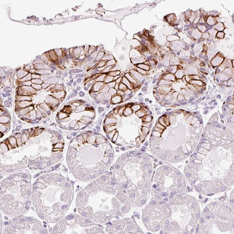 Immunohistochemical staining of human stomach, upper shows strong membranous positivity in glandular cells.