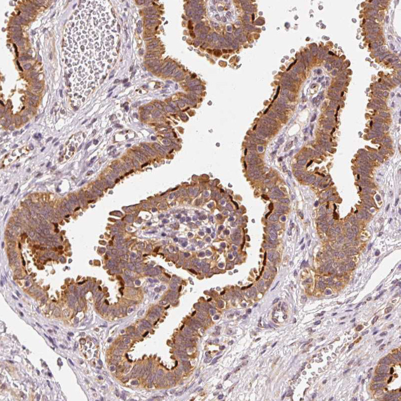 Immunohistochemical staining of human fallopian tube shows strong cytoplasmic positivity in glandular cells.