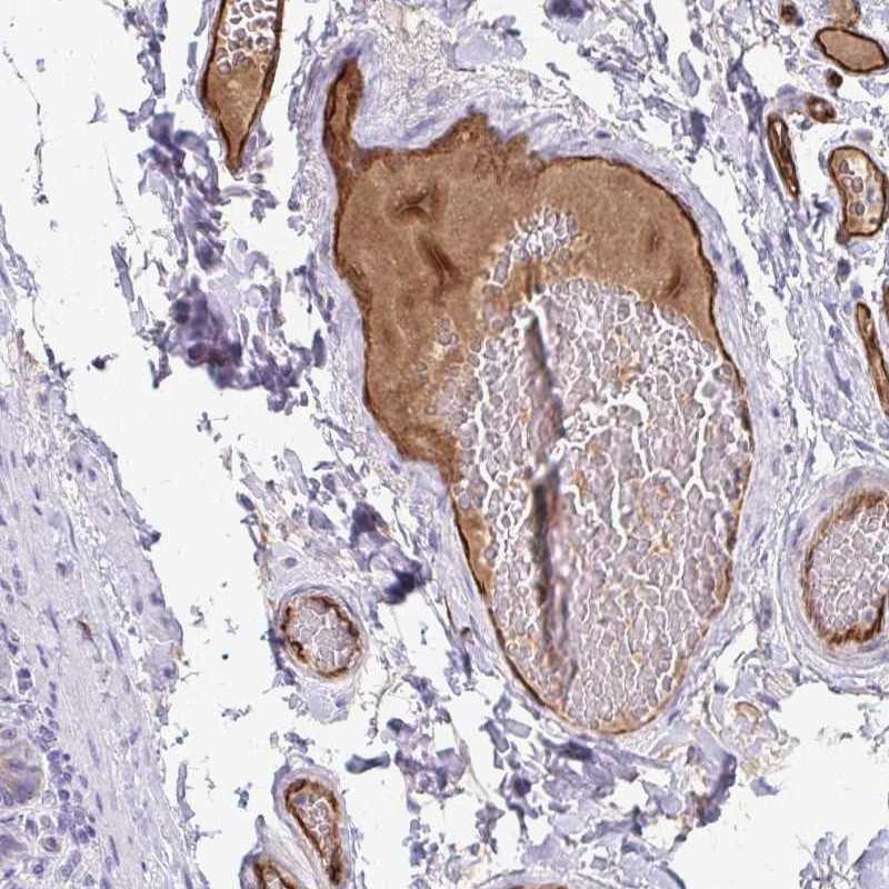 Immunohistochemical staining of human duodenum shows distinct positivity in plasma and endothelial cells.