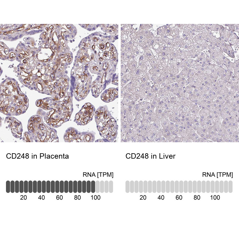 Immunohistochemistry analysis in human placenta and liver tissues using HPA051856 antibody. Corresponding CD248 RNA-seq data are presented for the same tissues.