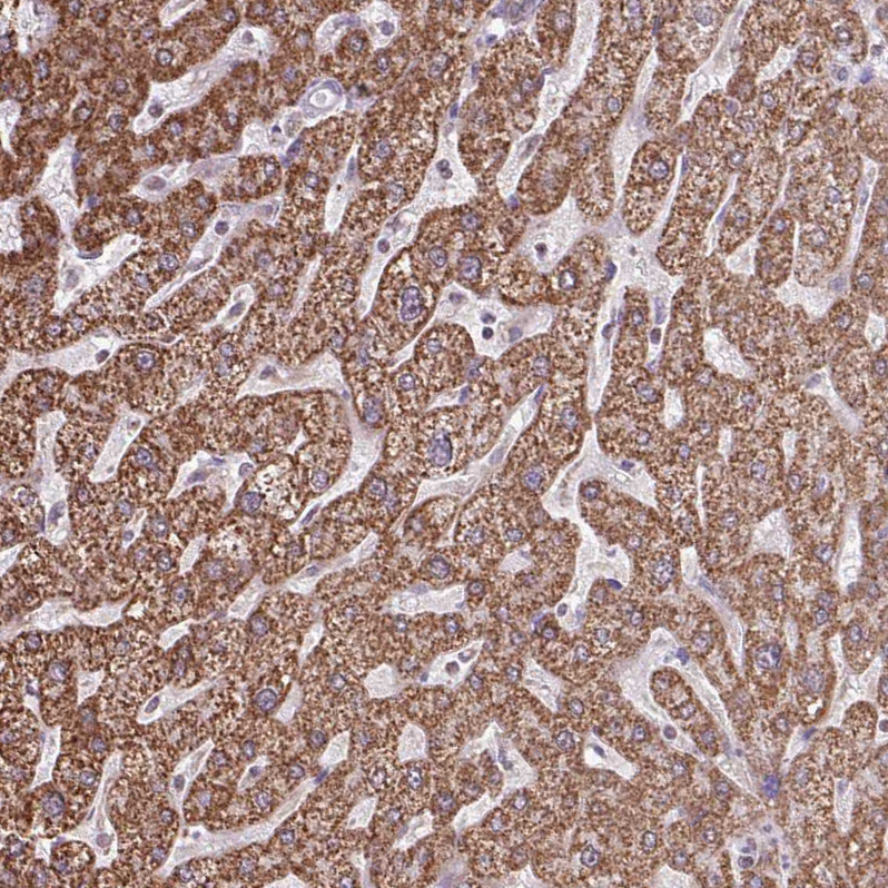 Immunohistochemical staining of human liver shows moderate granular cytoplasmic positivity in hepatocytes.