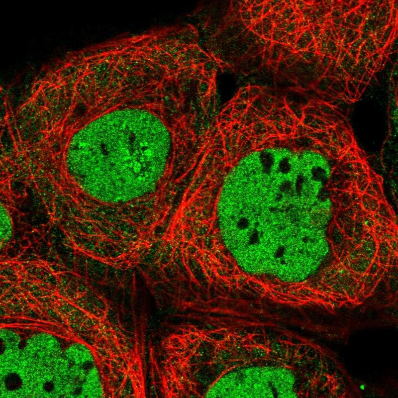 Immunofluorescent staining of human cell line A-431 shows localization to nucleoplasm.