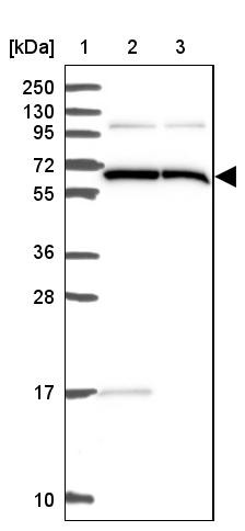 Lane 1: Marker [kDa] 250, 130, 95, 72, 55, 36, 28, 17, 10<br/>Lane 2: Human cell line RT-4<br/>Lane 3: Human cell line U-251MG sp