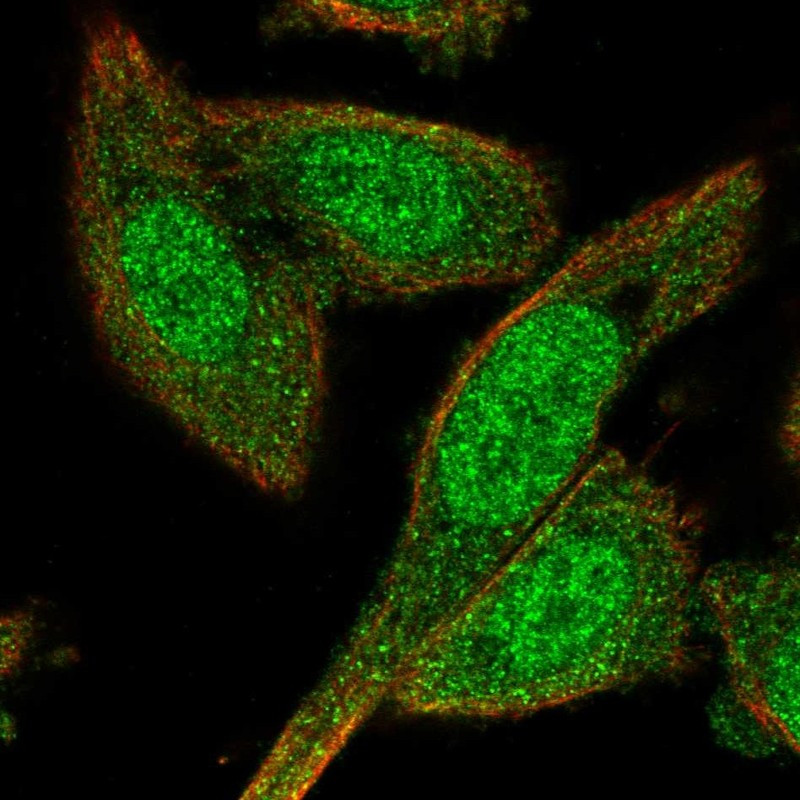 Immunofluorescent staining of human cell line PC-3 shows localization to nucleoplasm & cytosol.