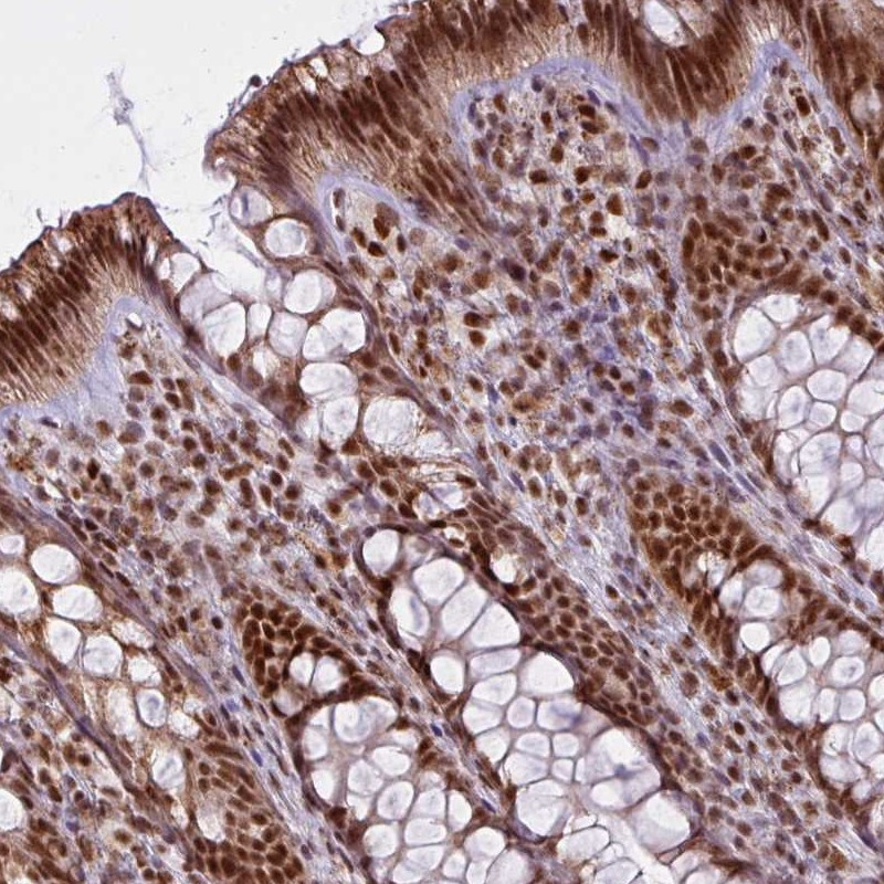 Immunohistochemical staining of human colon shows strong nuclear positivity in glandular cells.