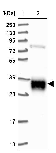 Lane 1: Marker [kDa] 250, 130, 95, 72, 55, 36, 28, 17, 10<br/>Lane 2: Human cell line RT-4