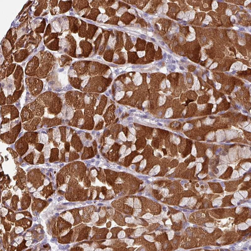 Immunohistochemical staining of human stomach, upper shows strong cytoplasmic positivity in glandular cells.