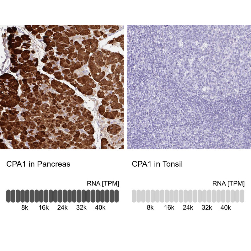 Immunohistochemistry analysis in human pancreas and tonsil tissues using Anti-CPA1 antibody. Corresponding CPA1 RNA-seq data are presented for the same tissues.