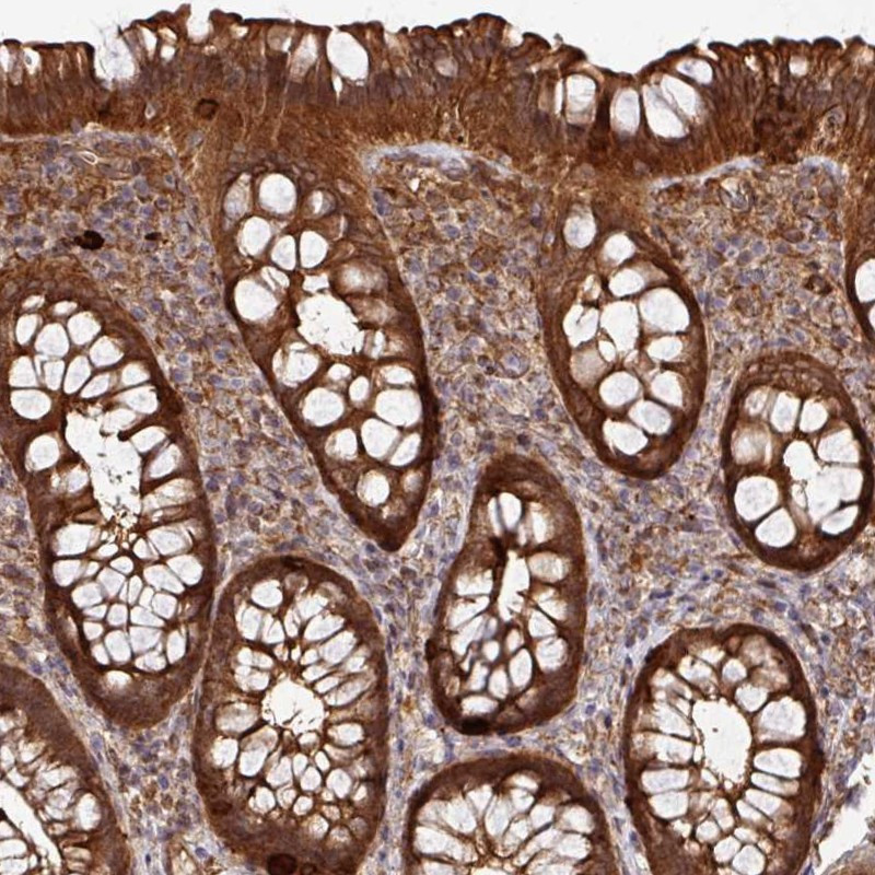Immunohistochemical staining of human rectum shows strong cytoplasmic positivity in glandular cells.