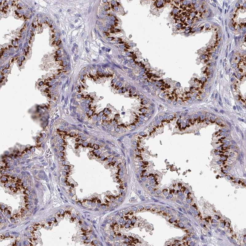 Immunohistochemical staining of human prostate shows strong granular cytoplasmic positivity in glandular cells.