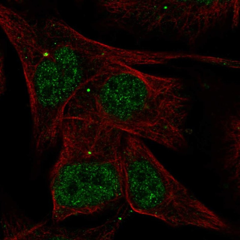 Immunofluorescent staining of human cell line SK-MEL-30 shows localization to nucleoplasm & centrosome.